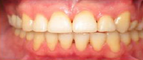 Best Dentist in Dhaka-Cosmodent Dental Care