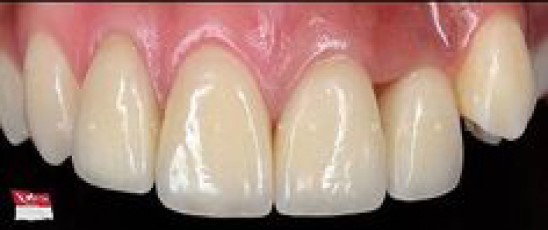 Best Dentist in Dhaka-Cosmodent Dental Care