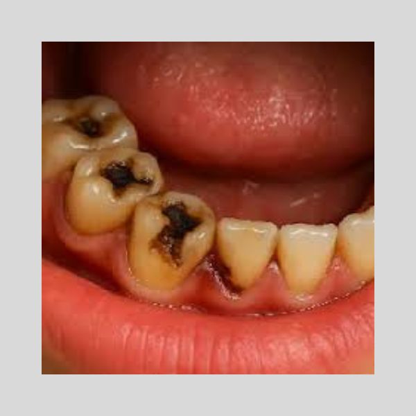 Reversing Cavities