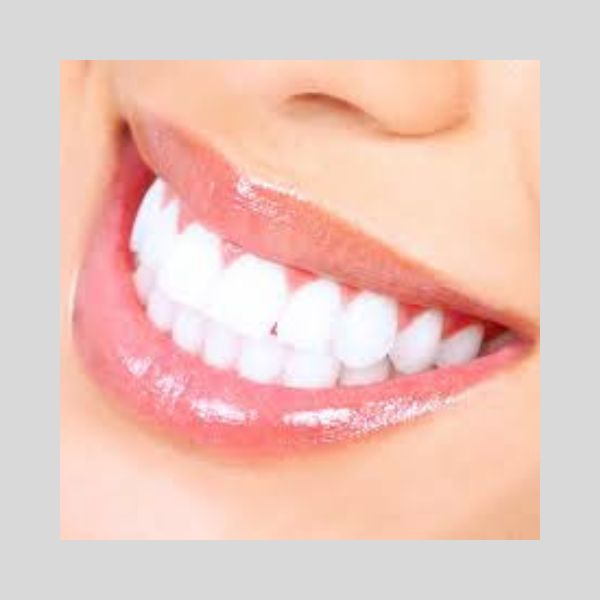 Teeth Whitening